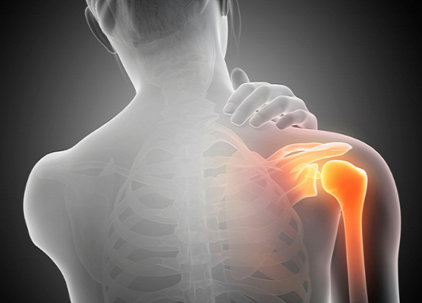 Understanding Frozen Shoulder - London Orthopedic Clinic