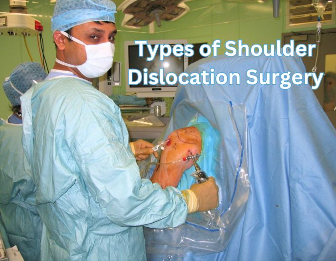 Types of Shoulder Dislocation Surgery