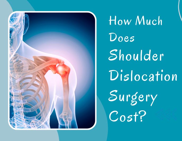 Shoulder Dislocation Surgery Cost