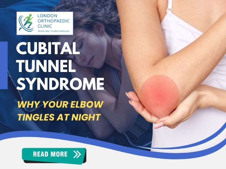 Cubital Tunnel Syndrome: Why Your Elbow Tingles at Night