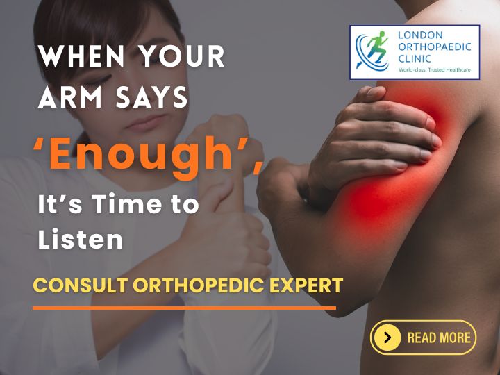 When Your Arm Says ‘Enough’, It’s Time to Listen