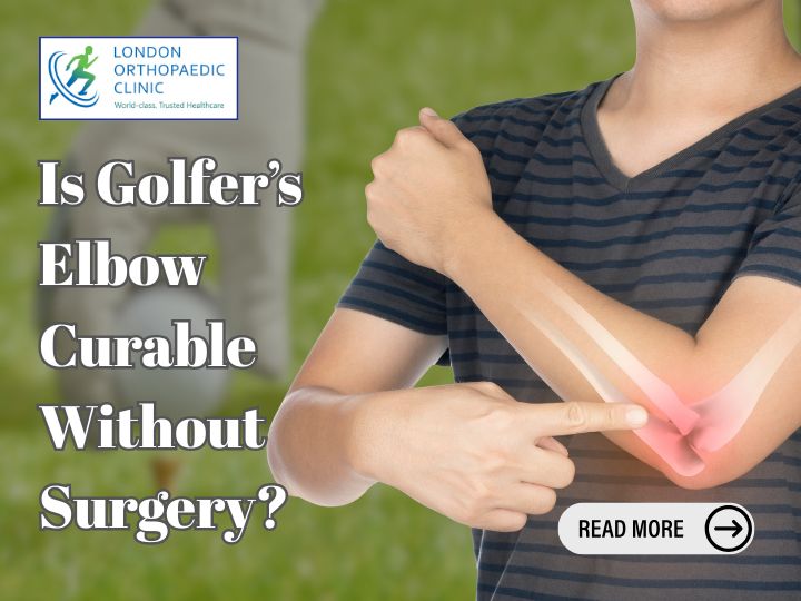 Is Golfer’s Elbow Curable Without Surgery?