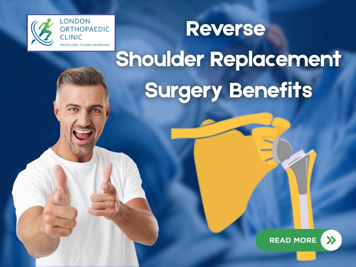 Reverse Shoulder Replacement Surgery Benefits