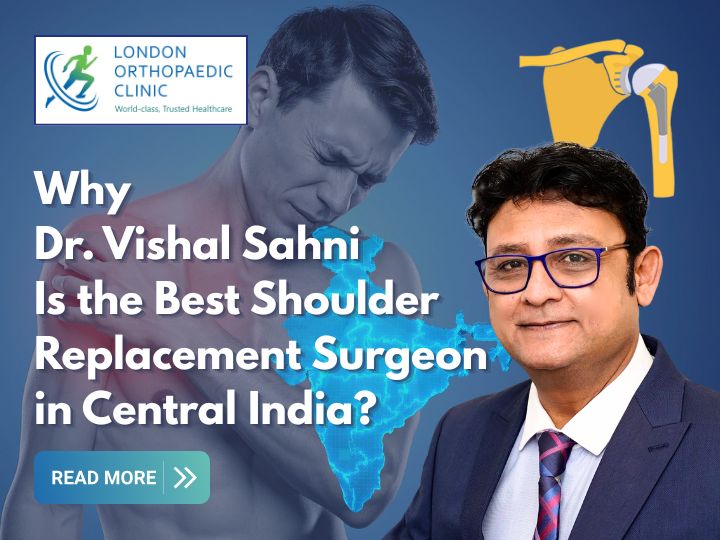 Why Dr. Vishal Sahni Is the Best Shoulder Replacement Surgeon in Central India