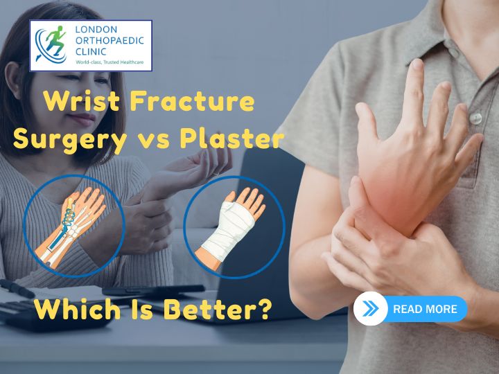 Wrist Fracture Surgery vs Plaster: Which Is Better?