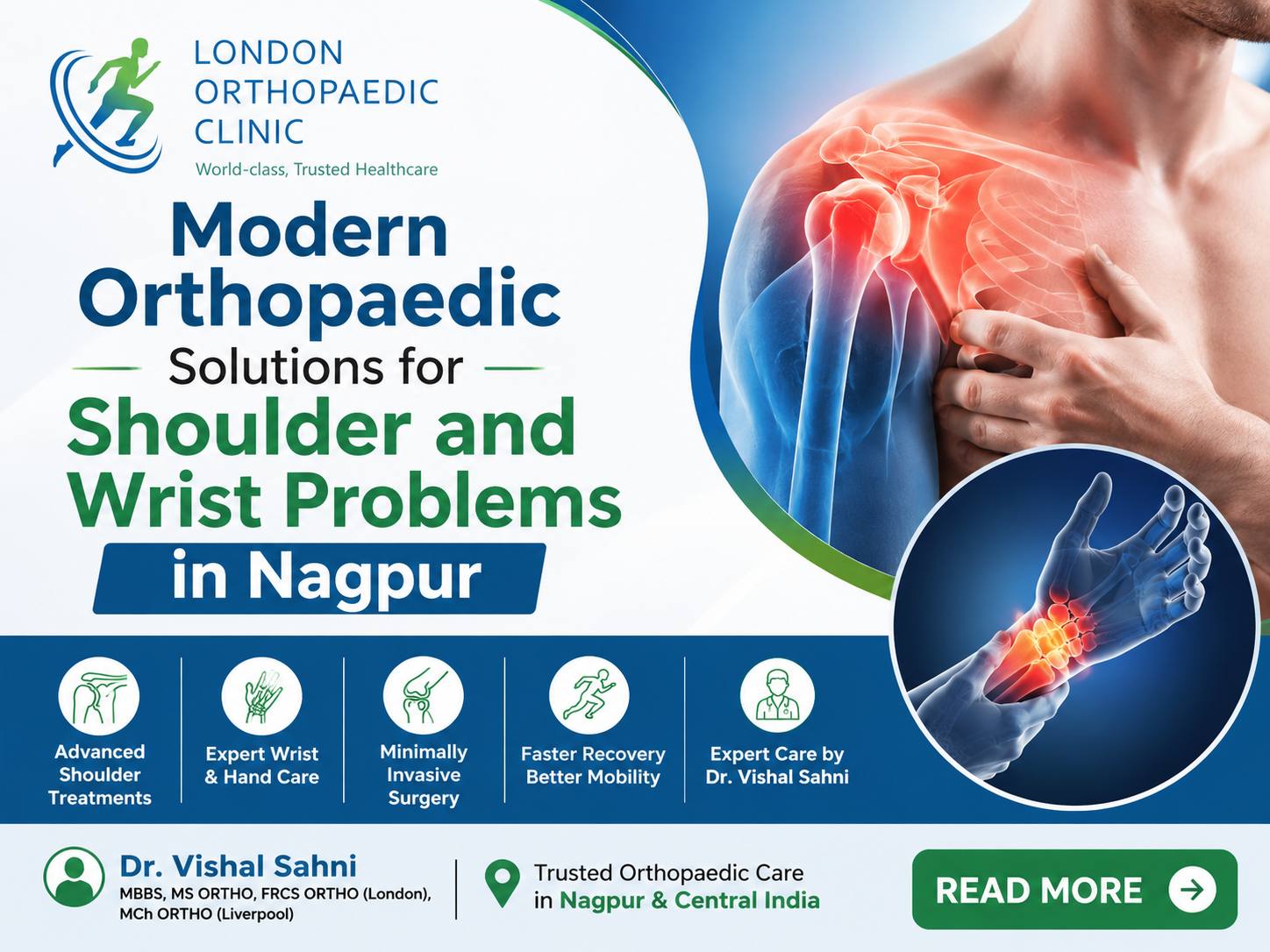 Modern Orthopaedic Solutions for Shoulder and Wrist Problems in Nagpur