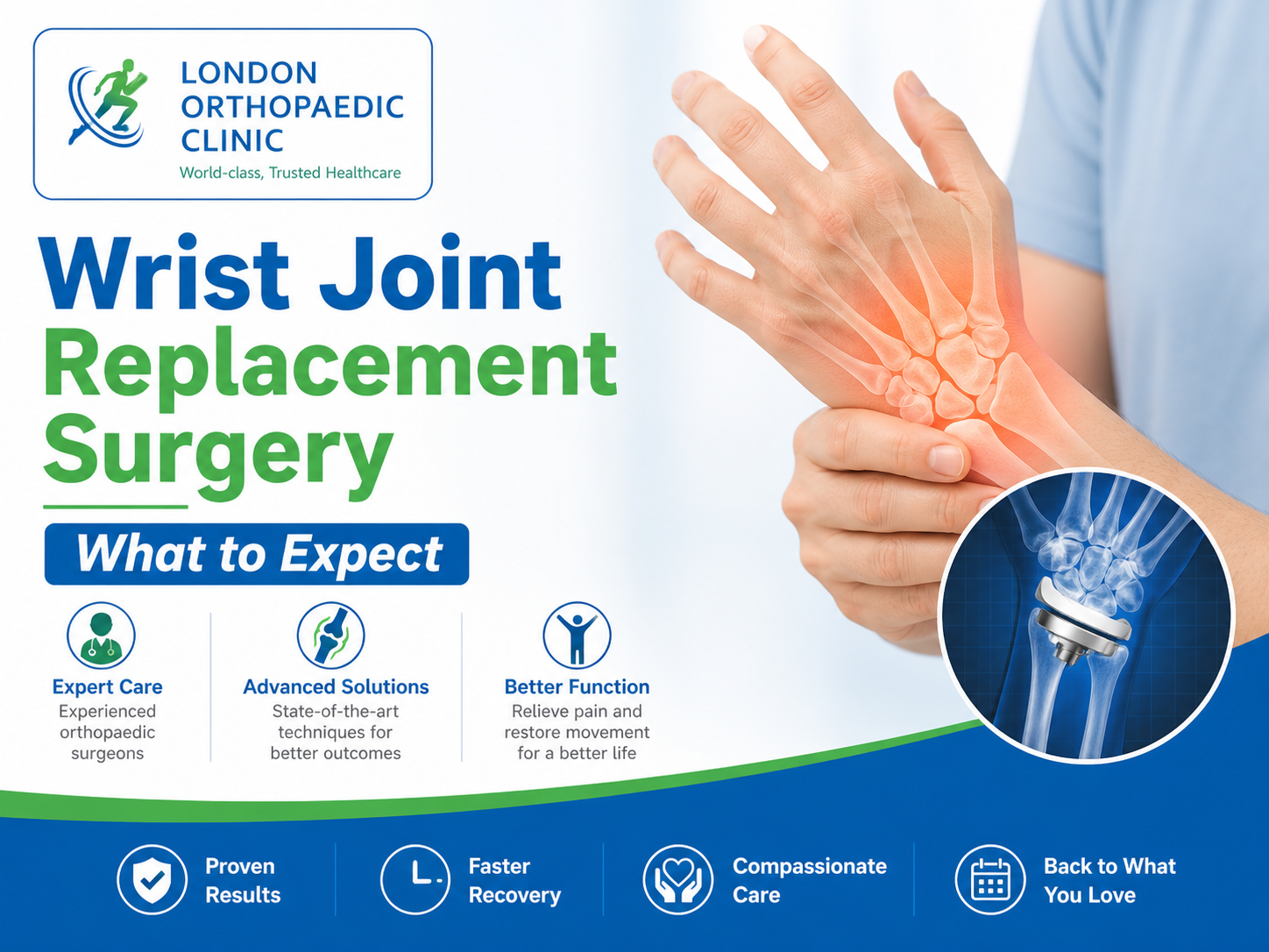 Wrist Joint Replacement Surgery: What to Expect