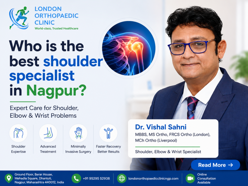 Who Is the Best Shoulder Specialist in Nagpur Complete Guide for Patients