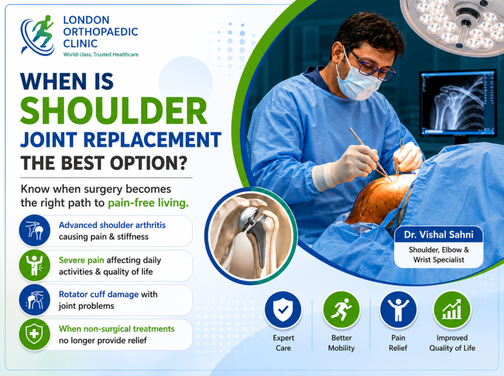 When Is Shoulder Joint Replacement the Best Option? A Complete Patient Guide
