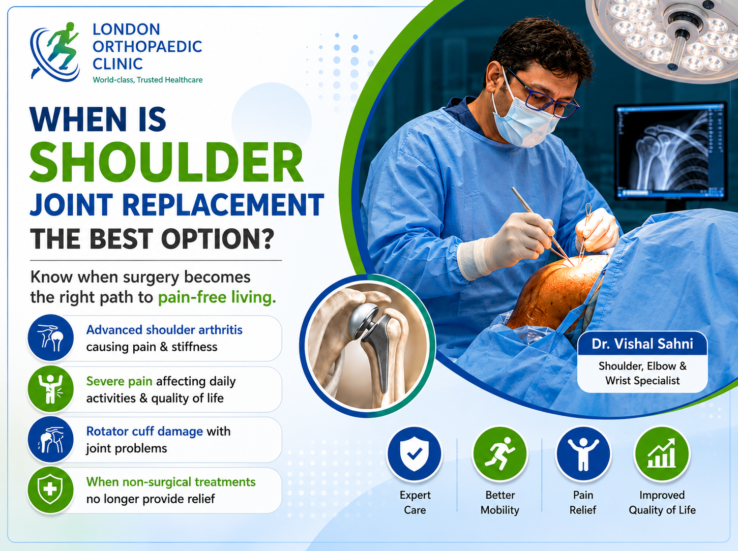 When Is Shoulder Joint Replacement the Best Option? A Complete Patient Guide